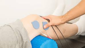 Image result for Electrical Stimulation Therapy