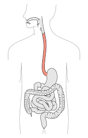 Announcer:have a question about a medical procedure? Esophagus Wikipedia