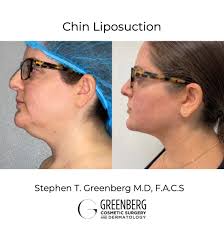 Dr Stephen Greenberg (@DrGreenberg)