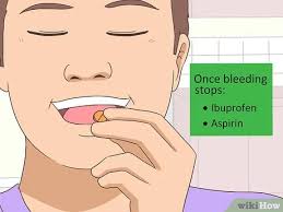 Good oral care, which should include brushing twice a day and cleaning between your teeth with an interdental device or floss changing your diet to treat nutritional problems, especially in case you have any vitamin deficiencies or hormonal issues 3 Ways To Reduce Tongue Swelling Wikihow