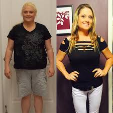 Gastric Sleeve Success Stories Freedom From Obesity Bariatric Surgery Source
