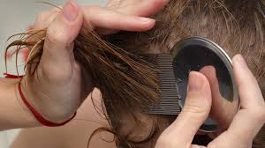 Clearly this is not as easy task, so try to get some help if possible. What Does Lice Look Like