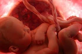 Fibroids tidak akan mencederakan bayi walaupun kedudukannya bersebelahan dengan bayi atau saiznya menjadi besar. Fibroid Semasa Mengandung Punca Simptom Komplikasi Rawatan Bidadari My