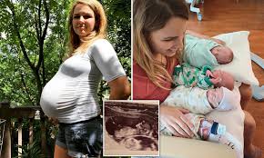 My friends are currently pregnant with twins from clomid. Mother 28 Reveals How She Gave Birth To Quadruplets After Three Miscarriages Daily Mail Online