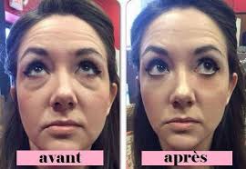 Poches Sous Les Yeux Comment S En Debarrasser En Quelques Jours Poches Sous Les Yeux Sous Les Yeux Soin Visage