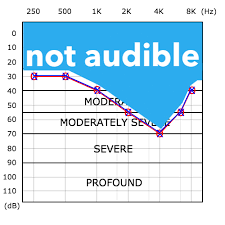 Video script (background music playing) here's an image of my most recent audiogram. Audiogram How To Read A Hearing Test Pro Fit Hearing