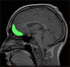 Understanding Psychopathic Criminals Psychology Today