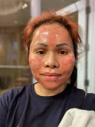 ad Today's Special Value at QVC is the NuFace Trinity Plus & The Fix along  with both serums. I saw the NuFace advertised by someone I follow