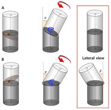 Asgwrn hir (cy) hestiyên ko dirêjiya wan ji firehiya. Unexpected Angular Or Rotational Deformity After Corrective Osteotomy Bmc Musculoskeletal Disorders Full Text