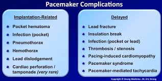 We did not find results for: Pacemaker Complications Implantation Related Pocket Grepmed