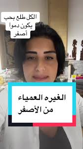 #fyp#ياجماعه خلص الأصفر الأكثر كريزما منعرف،خلص فيكن تسيروا متلنا،حاجي  تموتوا