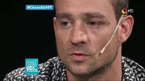 Check spelling or type a new query. Chano Moreno Charpentier De Tan Bionica Hablo Con Jorge Lanata Notife