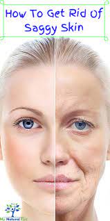 There are a number of options to choose from, but the very best skin tightening treatment depends on the area of concern. How To Get Rid Of Saggy Skin Saggy Face Skin Saggy Skin Remedies Saggy Skin