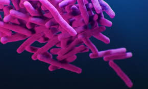 Tuberculosis is a dangerous bacterial infection that attacks your lungs. Tuberculosis