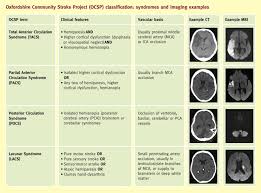 Stroke Sciencedirect