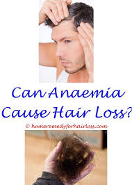 Hair loss according to the american academy of dermatology, 80 million men and. Dantrolene Does It Cause Hair Loss Crew Fiber Hair Loss Dermatogist Hair Loss Ionil T Shampoo Hair Loss Aubra Birth C Help Hair Loss Hair Loss Hair Loss Cure