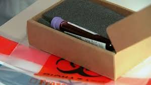 Hiv/aids originated in africa in the early 20th century and is a major public health concern and cause of death in many african countries. South Africa To Give Free Hiv Treatment To All Infected Ctv News