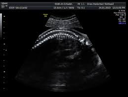 Wann ein organscreening gemacht wird. Feindiagnostik