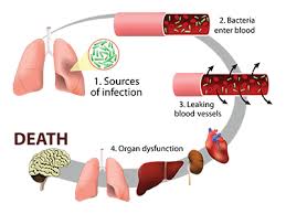 We did not find results for: Sepsis Meditatedwords