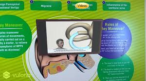 This exercise is for dizziness from the left ear and side: Vertigo Exercises For Android Apk Download