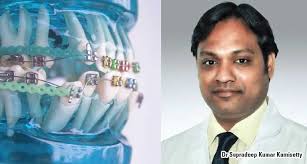 Next, identify the places in your mouth where your braces and wires are rubbing your cheek lining or gums. How To Use Wax For Your Braces The Guide Ways