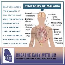 Malaria is spread by the bite of an infected anopheles mosquito and causes symptoms such as fever, aches, and nausea. Malaria Treatment Delhi Ncr Dr Prashant Saxena