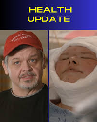 1000 Lb Sisters: Chris Combs Gives Update About Tammy Post-Skin Removal  Surgery, Says She Is Alive! More Details Below 👇👇👇