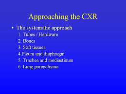 Maybe you would like to learn more about one of these? Reading The Cxr Frank Schembri Pulmonary Critical Care