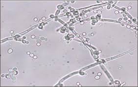 Image result for Tragia glabrata