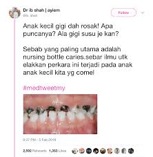 Upin ipin gigi susu musim 7 ep 2 hd. Kepentingan Gigi Susu Untuk Anak Buzzkini