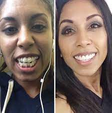 Pin On Smile