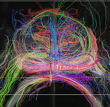He has a twin brother and older brother who he has encouraged to undergo testing for prostate cancer, but still neither have gone. Men With Early Prostate Cancer Can Safely Opt Out Of Treatment