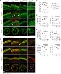 Explore the essential tools and techniques for character animation in after effects by working through examples that examine each feature as it. Sox2 And Fgf20 Interact To Regulate Organ Of Corti Hair Cell And Supporting Cell Development In A Spatially Graded Manner