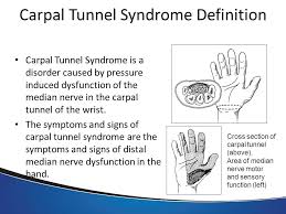 Learn about carpal tunnel syndrome, a common condition where the median nerve in the wrist is compressed, causing pain and numbness throughout your hand. Common Hand Disorders Mark Shreve Md Ppt Video Online Download