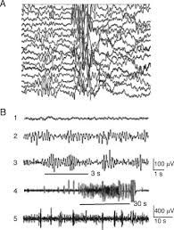 Jun 25, 2019 · the blind mans faith in jesus is what allowed him to be healed. Seizures In Mouse Models Of Rare Neurodevelopmental Disorders Sciencedirect