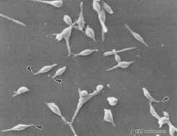 Mycoplasma pneumoniae and Its Role as a Human Pathogen | Clinical  Microbiology Reviews