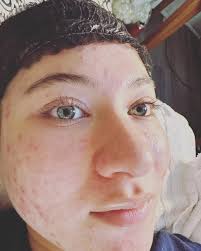 Before and after pics of this beauty . Lash Lift using medium barrel .