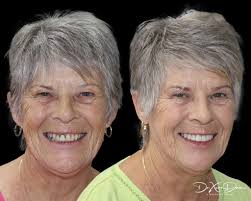 Jindalee Smiles Dental