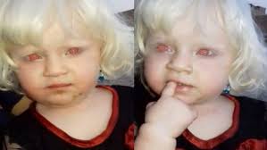 Why don't humans have red or red brown eyes even though they have red  pigment (pheomelanin)?