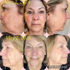 We are thrilled to announce a dynamic 𝐊𝐢𝐧𝐞𝐒𝐲𝐬 collaboration between  our esteemed 𝗗𝗼𝗰𝘁𝗼𝗿 𝗠𝗮𝗻𝘂𝗲𝗹 𝗖𝗲𝗷𝗮 and the talented  𝗘𝘀𝘁𝗵𝗲𝘁𝗶𝗰𝗶𝗮𝗻 𝗠𝗶𝗿𝘁𝗮 𝗦𝗮𝗻𝗱𝗼𝗺𝗶𝗿! 💫✨