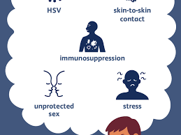 Herpes Causes And Risk Factors