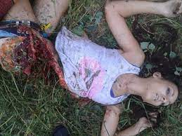 An area for real crime related death videos that do not fit into other areas. 19yo Girl Killed By A Bomb In Ukraine