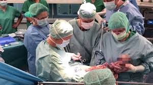 Baby Kommt Nach Gebarmuttertransplantation Auf Die Welt Uniklinik Tubingen Youtube