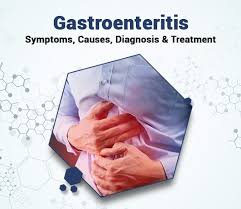 It is not the same as influenza. Gastroenteritis Symptoms Causes Diagnosis Treatment