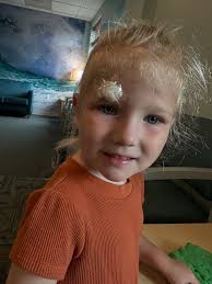 So my granddaughter who lives in BUFFALO fell at the playground today,  cutting her head above her eye. She needed a stitches. As the doctor was  stitching her forehead, she looked up