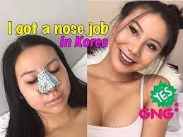 Hi everyone!!!in this video i am doing some research into getting a nose job in korea. Plastic Surgery In Korea Before After Rhinoplasty Transformation Gng Hospital Youtube