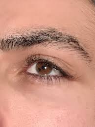 The lines are open from 9am to 5pm, monday to friday. A Rare Eye Cancer Showed Up In Three Friends Doctors Want To Know If The Cases Are Connected 36 Auburn University Graduates Develop Rare Eye Cancer Years Apart Things Uncle John Sends