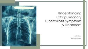 Image result for Extrapulmonary Tuberculosis