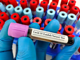 Diego ramos/afp via getty images the world health organization. Coronavirus Texas Hospital System Confirms Its 1st Case Of Covid 19 Lambda Variant Fox23 News