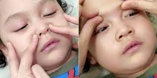 Bayi dengan hidung tersumbat akan kesulitan bernafas sehingga bayi akan sering sekali rewel dan memangis. Hidung Bayi Tersumbat Cara Mengurut Hidung Bayi Beserta Gambar Theasianparent Malaysia